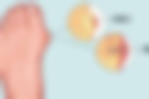 黑眼袋怎么产生的——饮食不均衡酿成的“眼部危机”