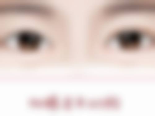 告别疤痕，重拾自信