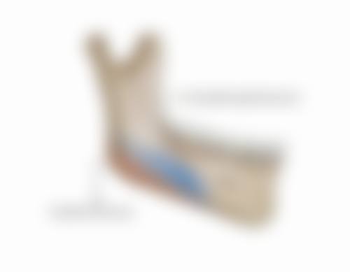 黑眼袋怎么产生的？熬夜遗传双杀，年龄疾病用眼过度全解析