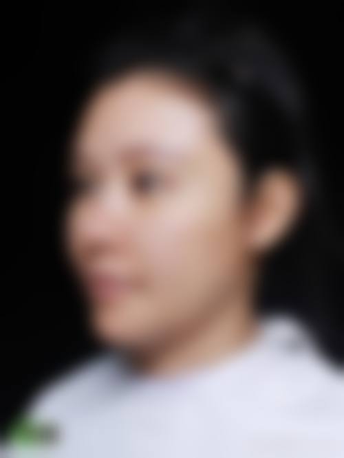 金鸿烈医生做手术价格情况