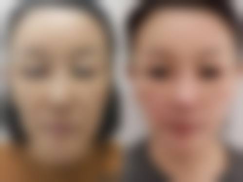 金鸿烈医生项目优势解读