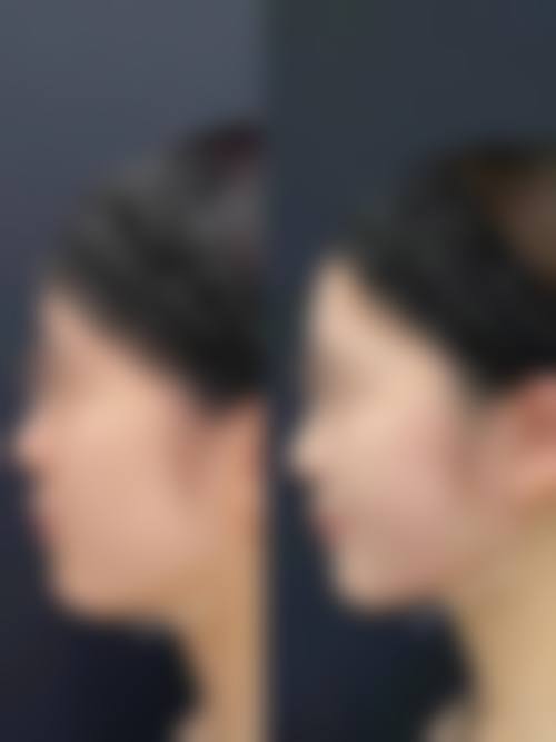 惠州雍禾医疗美容诊所更擅长什么手术