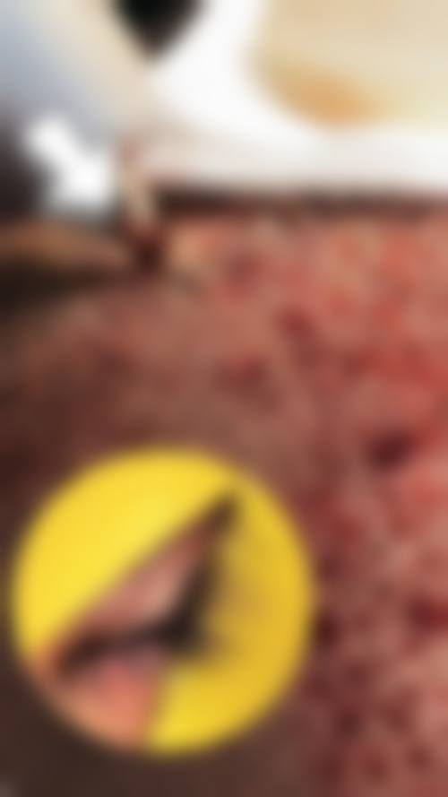 芜湖伊莱美整形美容医院价格表