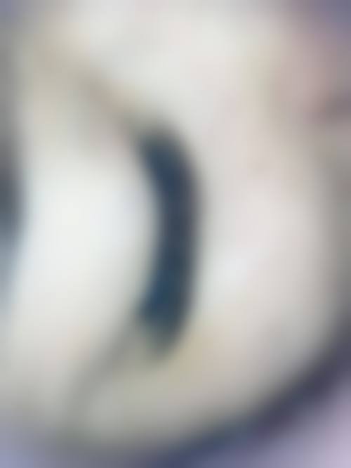 台州新凤凰医疗美容门诊部怎么样