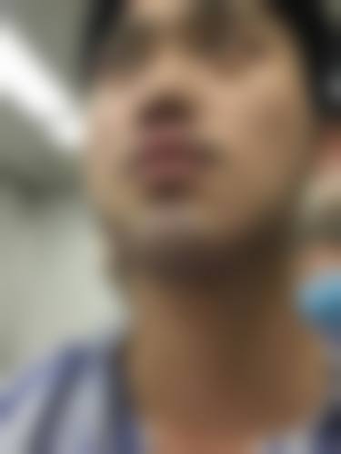 田林医生简介做手术价格