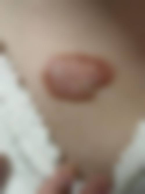 冯舸医生怎么挂号