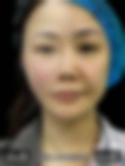 惠州雍禾医疗美容诊所价格表