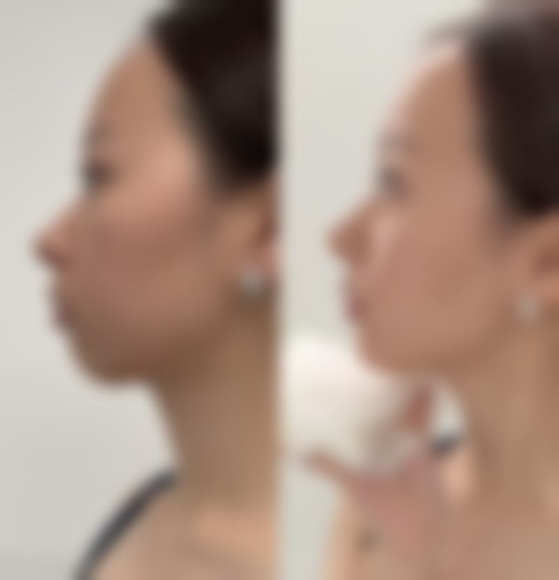 扬州俏华美医疗美容诊所高军飞排名第几位——扬州第二人民医院皮肤科