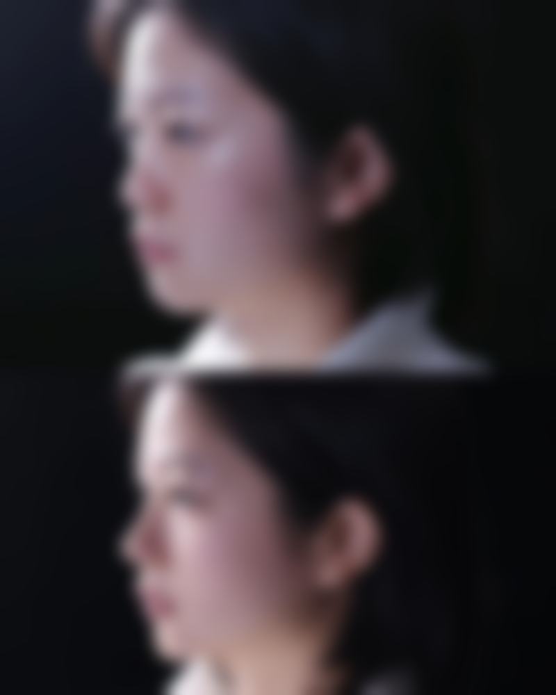 黑眼袋怎么产生的——遗传赋予的“独特印记”