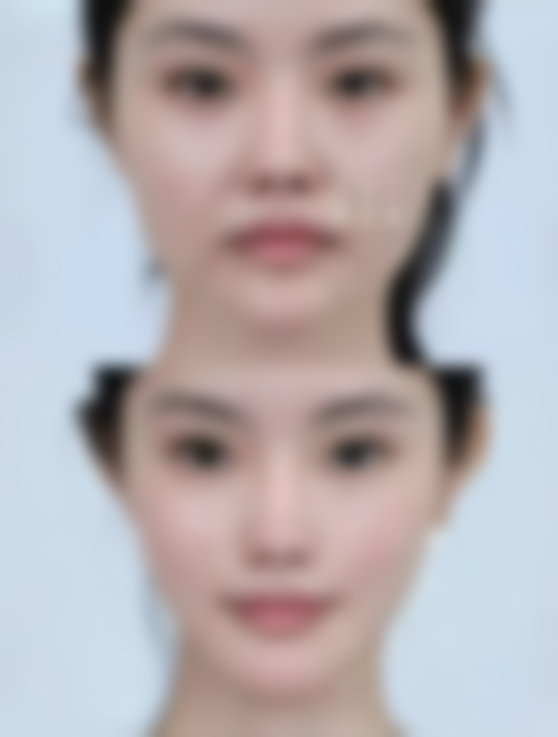 郑静医生简介项目优势