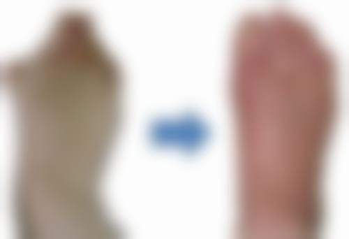 宝尼达隆鼻多久修复更好状态——终极建议：耐心是更好的“美容剂”