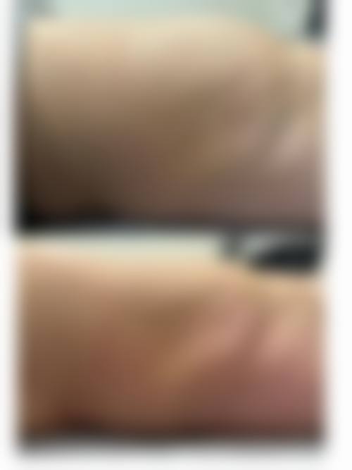 dr cream吸脂中 心怎么样,医生简介