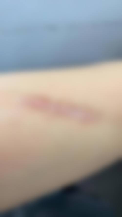 重庆造美坊整形美容门诊部价格表