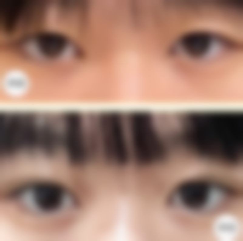 韩国TouchU整形外科口碑好不好