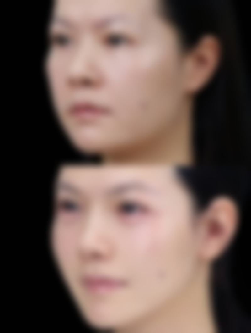 杨建勋医生项目优势