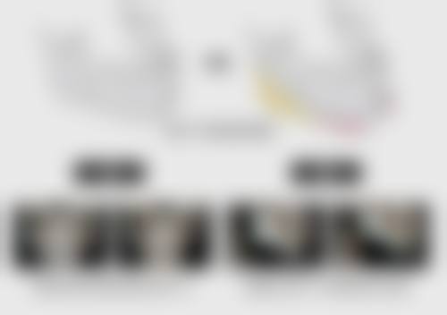 除皱针打一次能管多久之除皱部位的影响