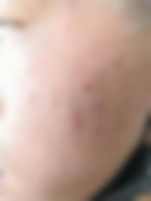 日本圣心医疗美容医院小林美幸医生项目优势