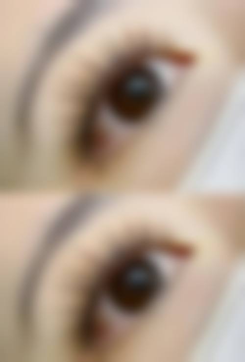 济南大麦微针植发资质