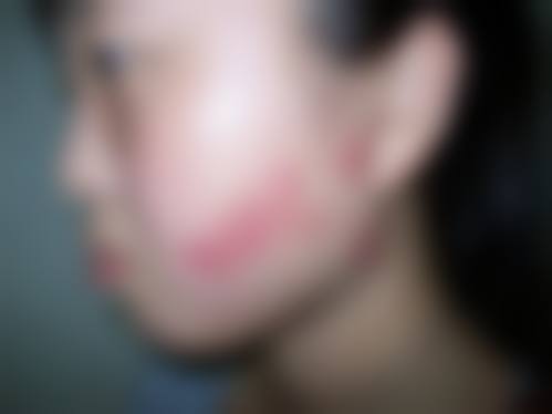 刘铭然医生简介怎么挂号