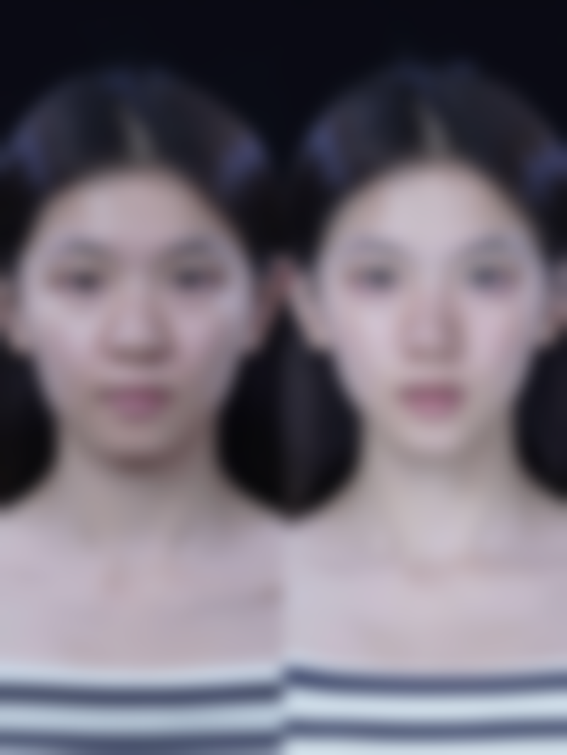 张心雅医生怎么挂号