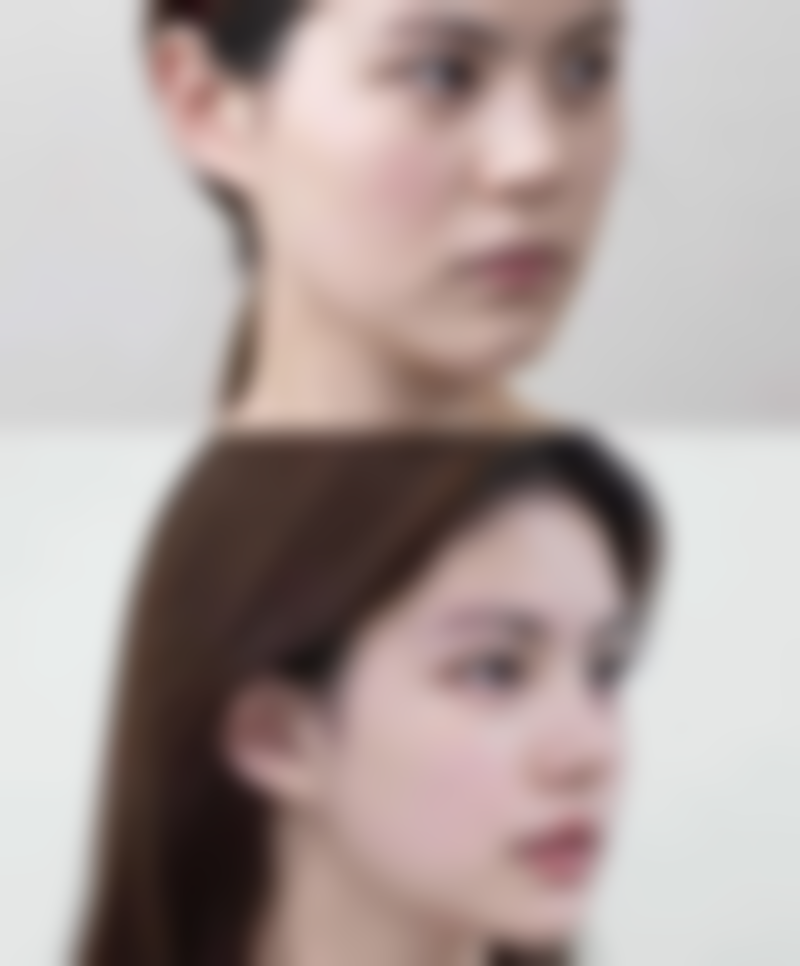 假体隆胸手术会死吗——基础病患者的高风险因素