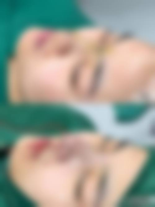 合肥瑶海福华医疗美容门诊部整形纠纷事件整理