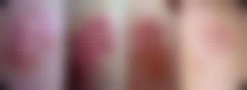 合肥瑶海福华医学整形机构抖音团购活动及价格表