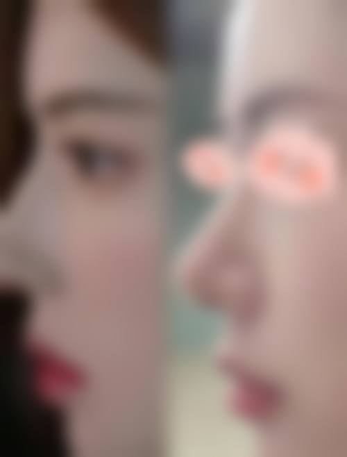 崔奎振医生怎么挂号