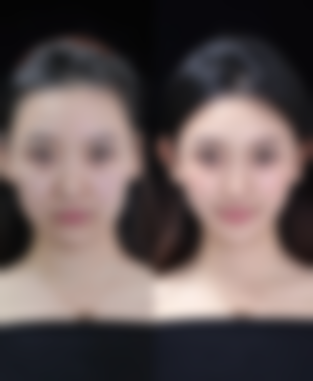 上海比华利整形医院价格表