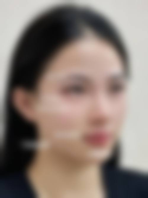 郑绪模医生简介项目优势