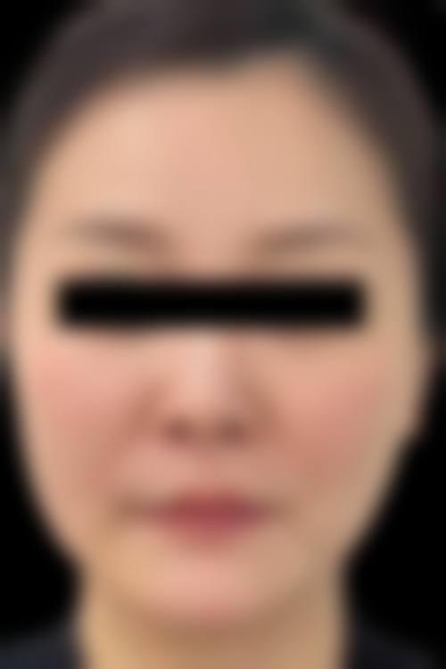 吉林林燕整形医院怎么样,口碑评价如何?