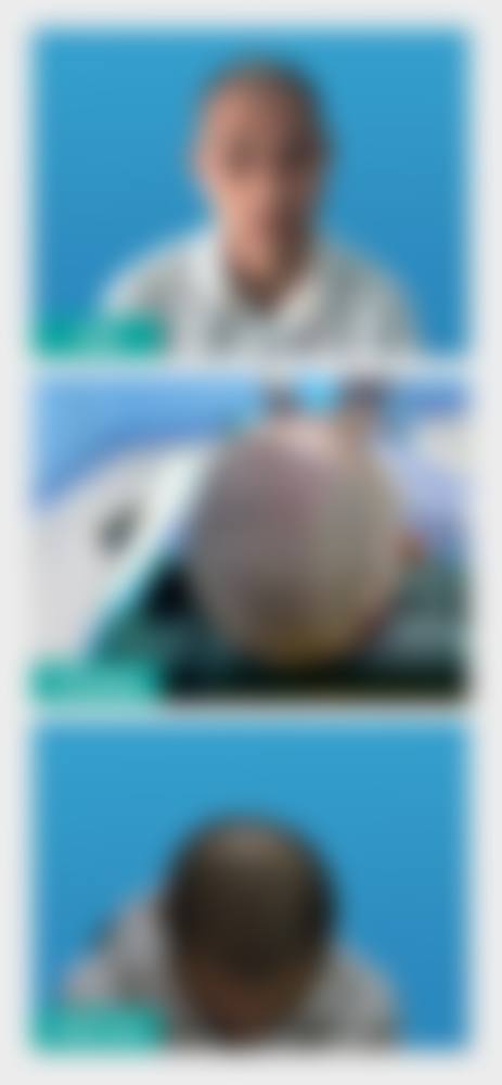 吉林林燕整形医院怎么样项目特色