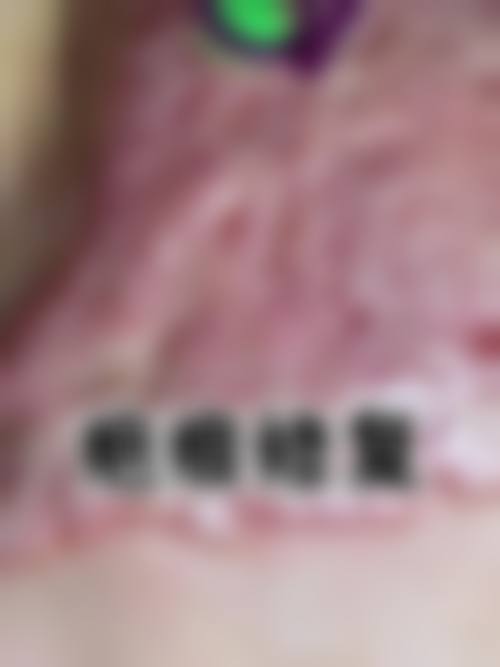 深圳市宝安人民医院整形科医生简介