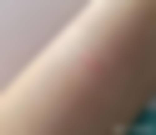 太原悦己蜜医疗美容诊所可靠吗