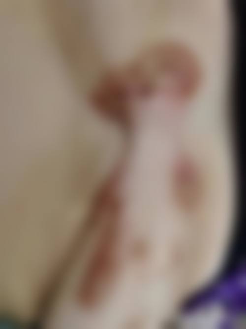 深圳市宝安人民医院整形科真实患者口碑评价