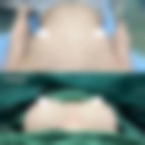 惠州惠阳长安医院医疗美容科基本信息及怎么样