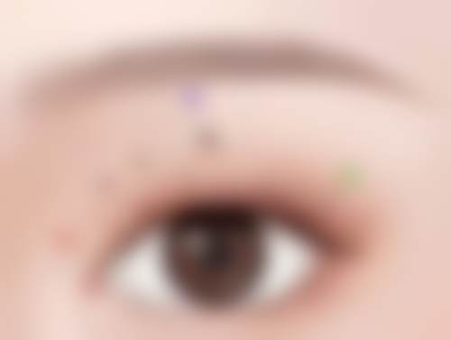 成都西区医院整形外科面部提升表现