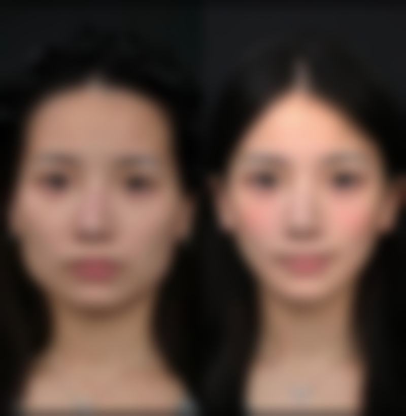 李仁胜医生简介项目优势