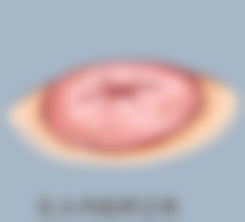 疤痕性青春痘如何治疗？激光+药物双管齐下，中医调理更温和