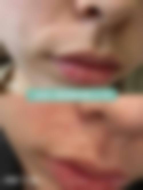 三、广州瑞美整形医院怎么样——口碑评价如何