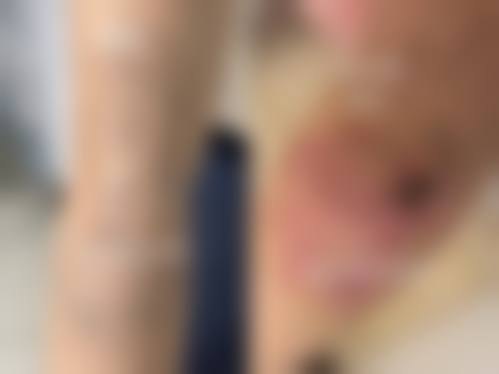 拉萨莱希整形医院口碑评价如何