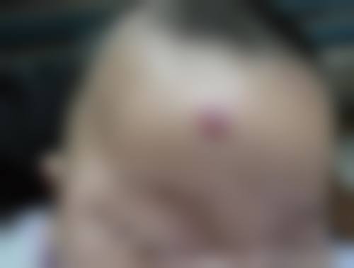 乔海侠医生口碑如何