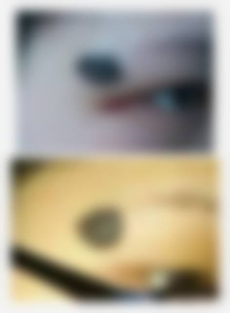 成都延思嘉医疗美容诊所更擅长什么手术