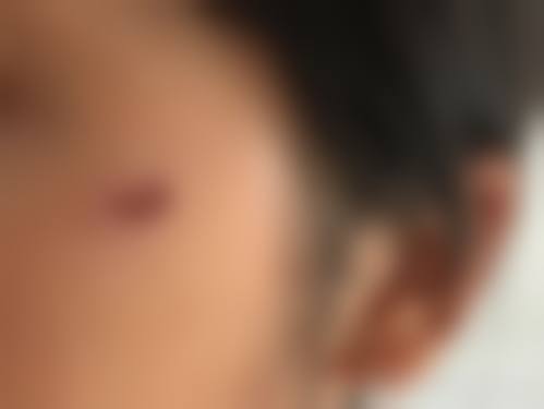 许晓妮医生简介项目优势