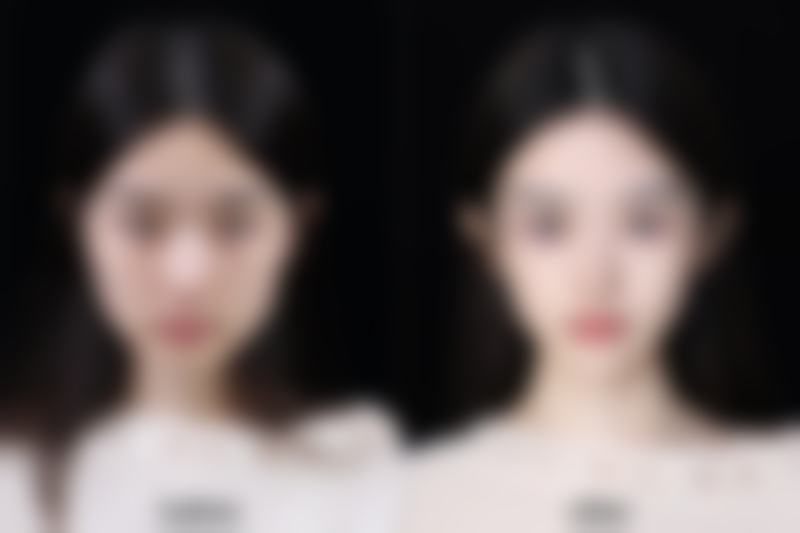 参军身体有手术疤痕可以吗？其他部位疤痕的生存指南