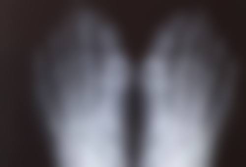 美丽背后的“代价”