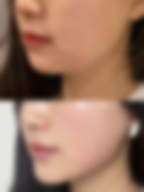 泰州太喜柏丽医疗美容的口碑好不好