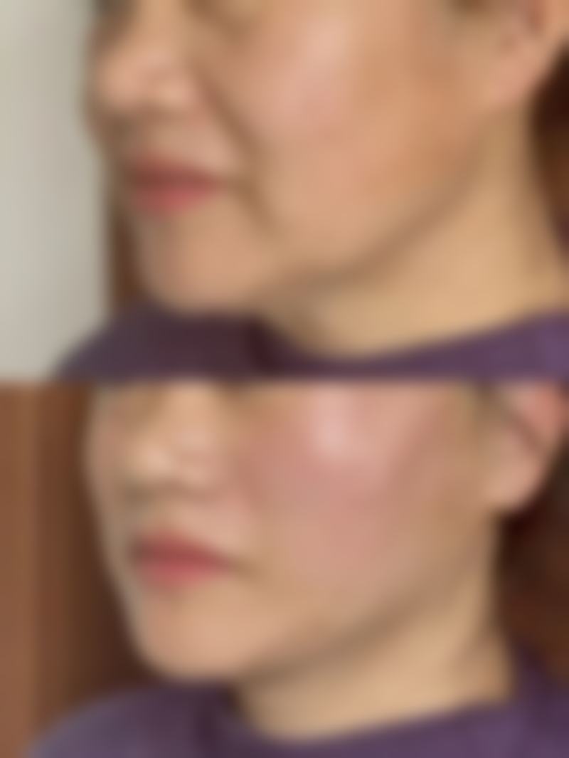 谭榕医生简介做手术价格