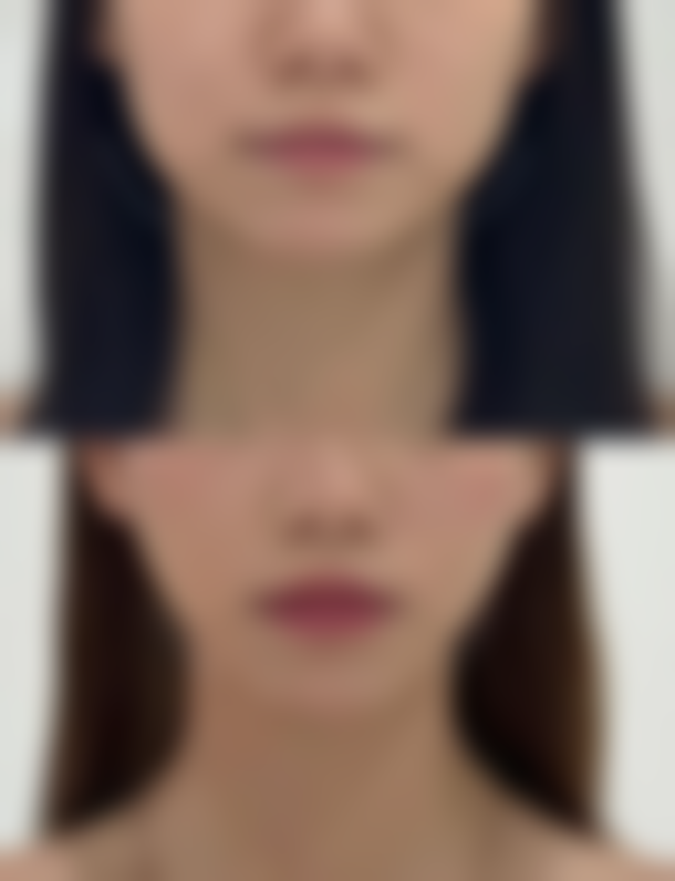 武汉斯启诺医疗美容门诊部彭华伟擅长项目——推荐指数与项目点评