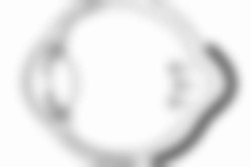 身体肥胖可以抽脂吗——女性产后肥胖与抽脂时机